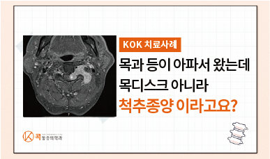 목과 등이 아파서 왔는데 목디스크가 아니라 척추종양이라고요?