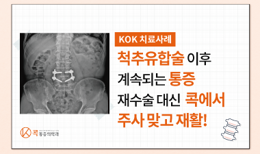 척추유합수술 후에도 지속된 통증, 콕에서 재수술 대신 주사 맞고 재활